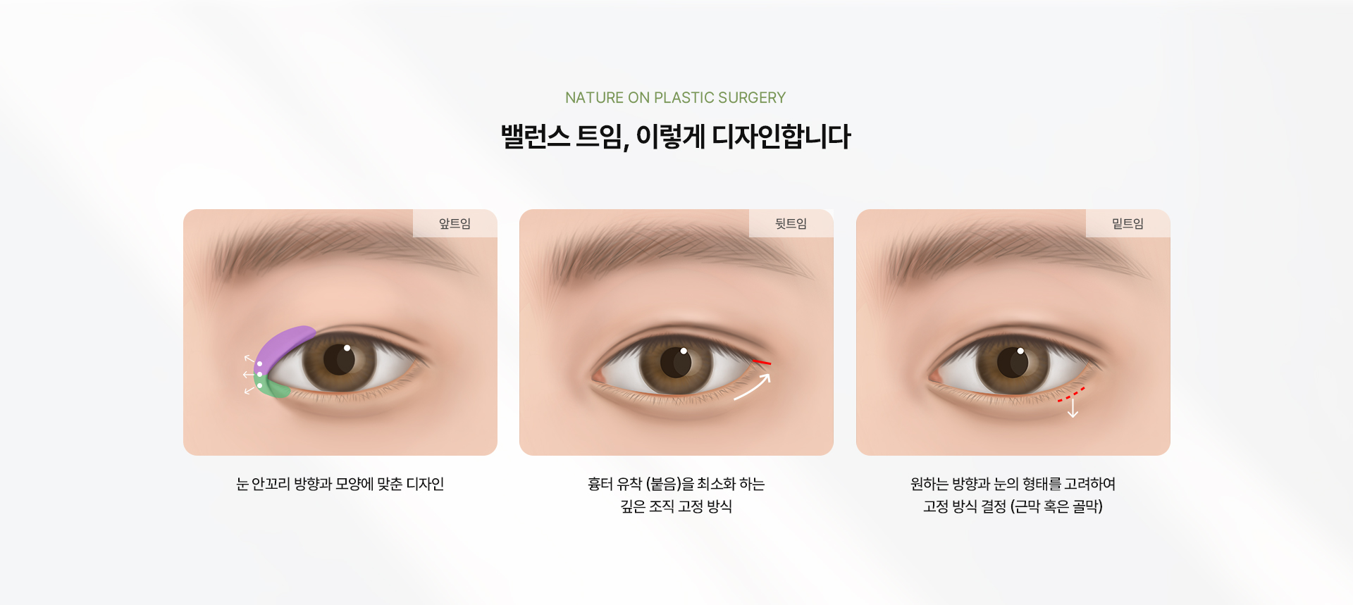 밸런스 트임 상세04