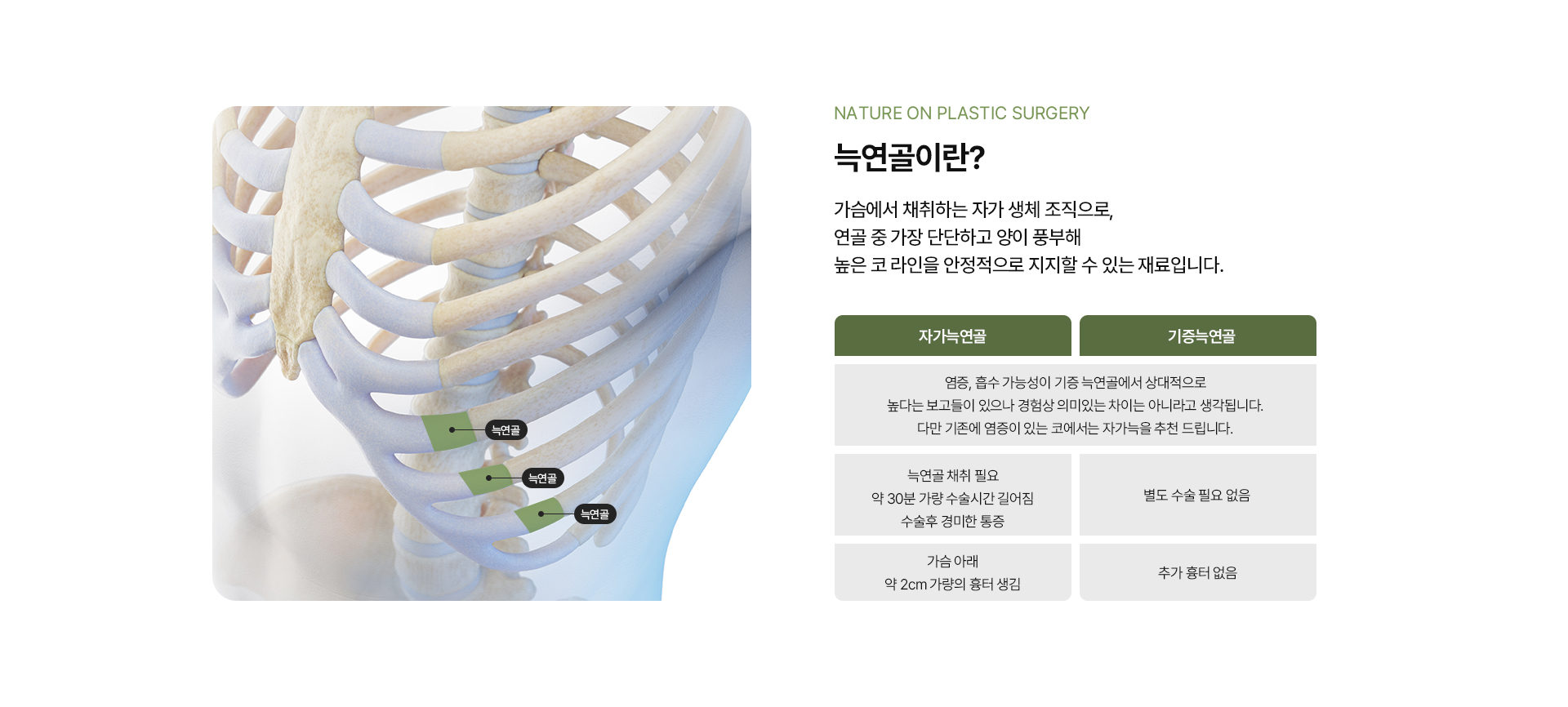 늑연골자려라인코성형 상세04
