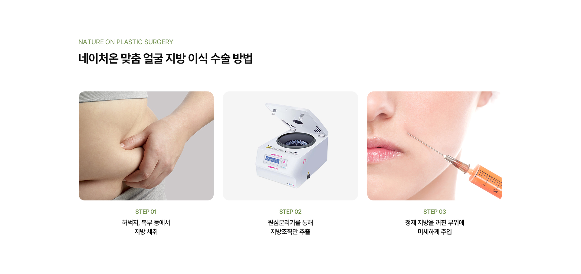 맞춤얼굴지방성형 상세04