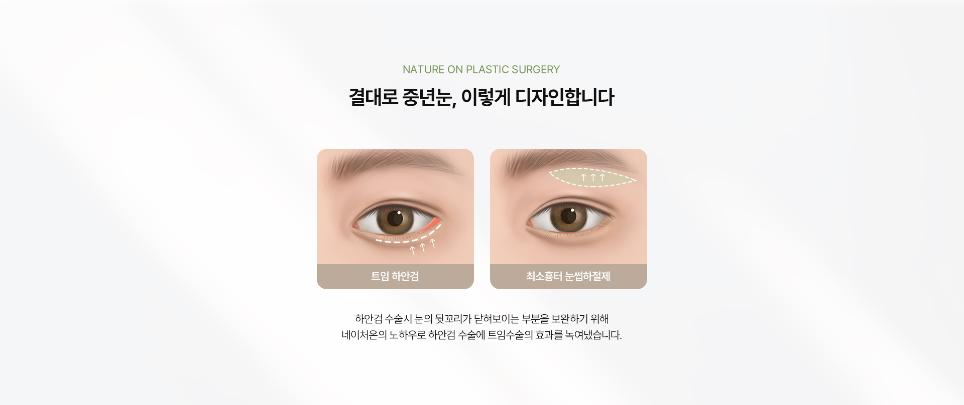 트임하얀검최소흉터눈썹하절제 상세04