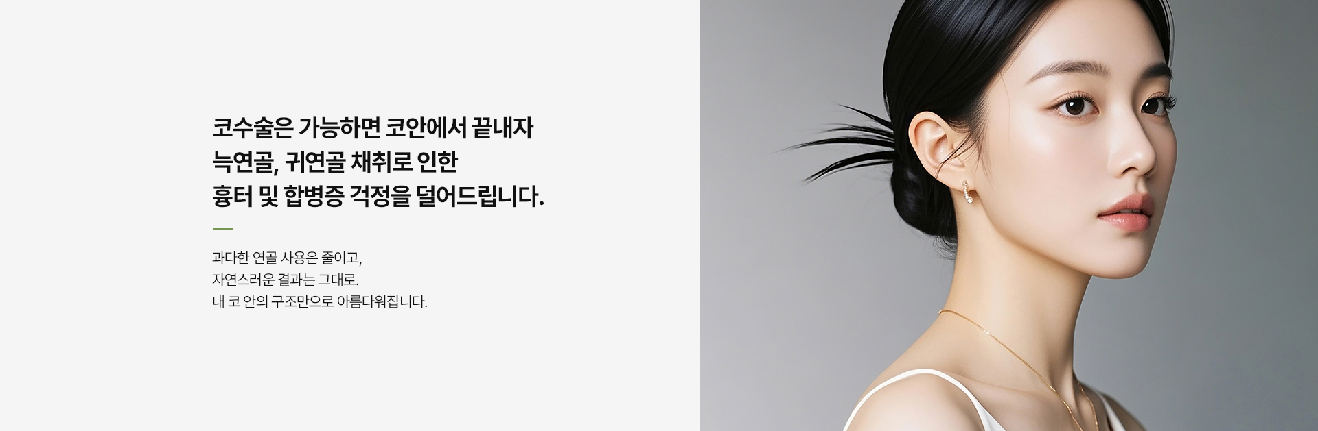 최소연골소프트라인코성형 상세03