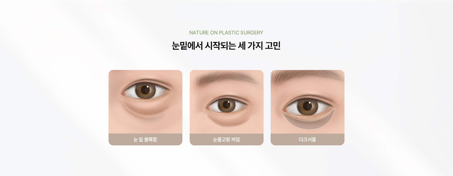 밸런스 트임 상세04