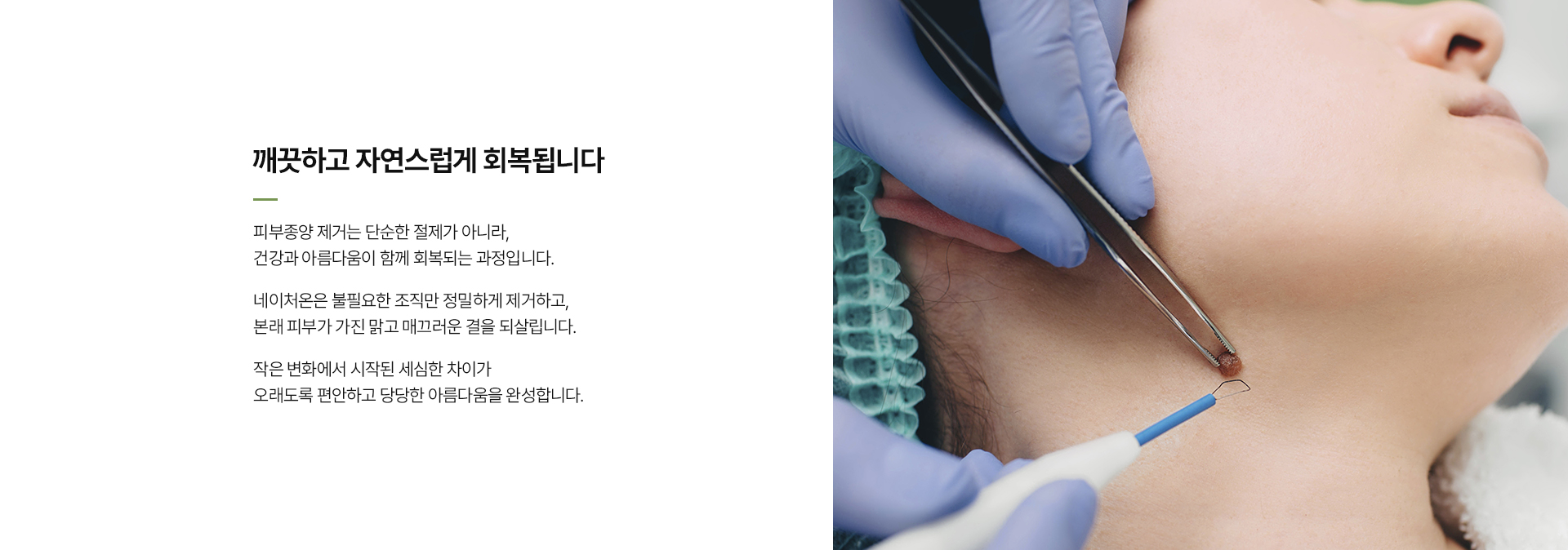 상처봉합피부종양 상세07